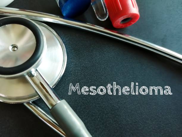 Mesothelioma Attorney